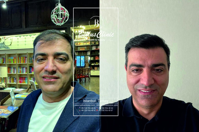 Slider image (1) Bellus Clinic